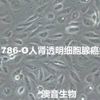 786-O[786-o; 786O; 786-0; 786.O; 786-O RCC; RCC 786-O; RCC_7860; RCC 7860; 7860; 786-0WT] 人肾透明胞腺癌细胞