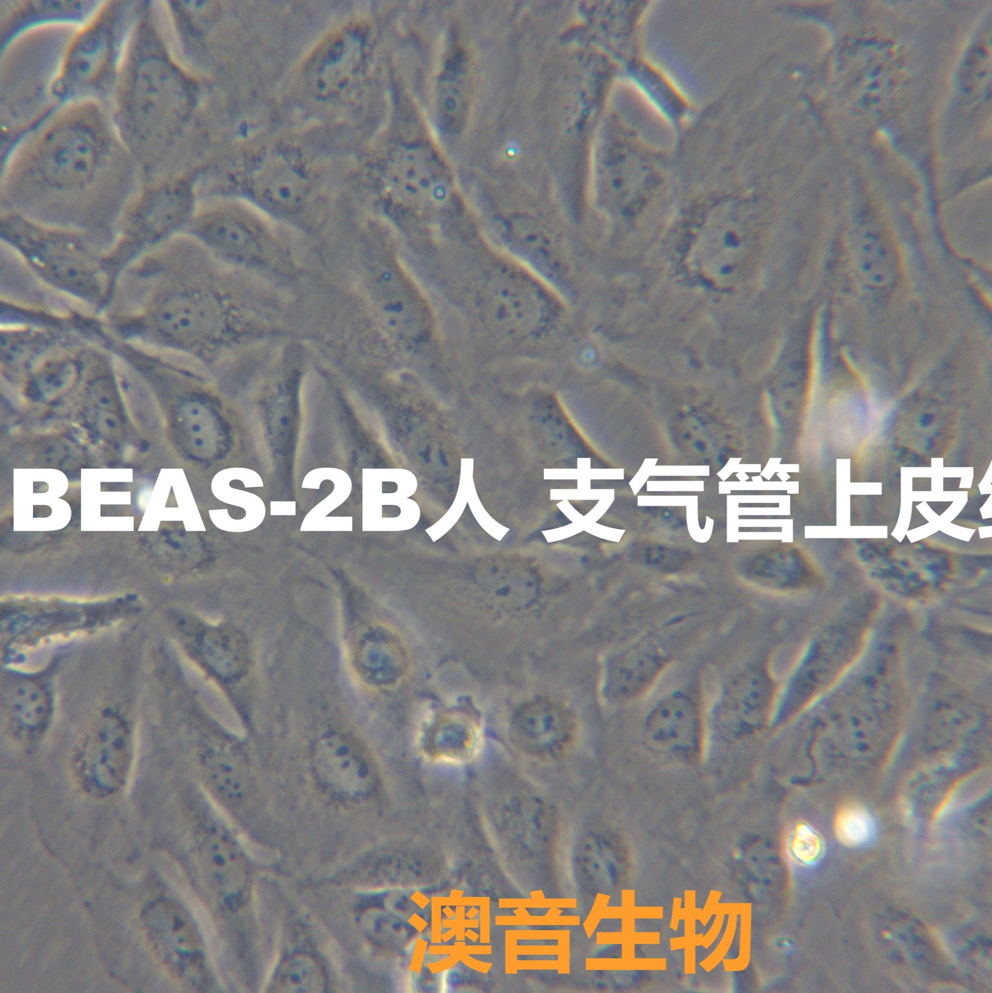 BEAS-2B【Beas-2B; BEAS 2B; BEAS2B; Beas2B】人支气管上皮细胞