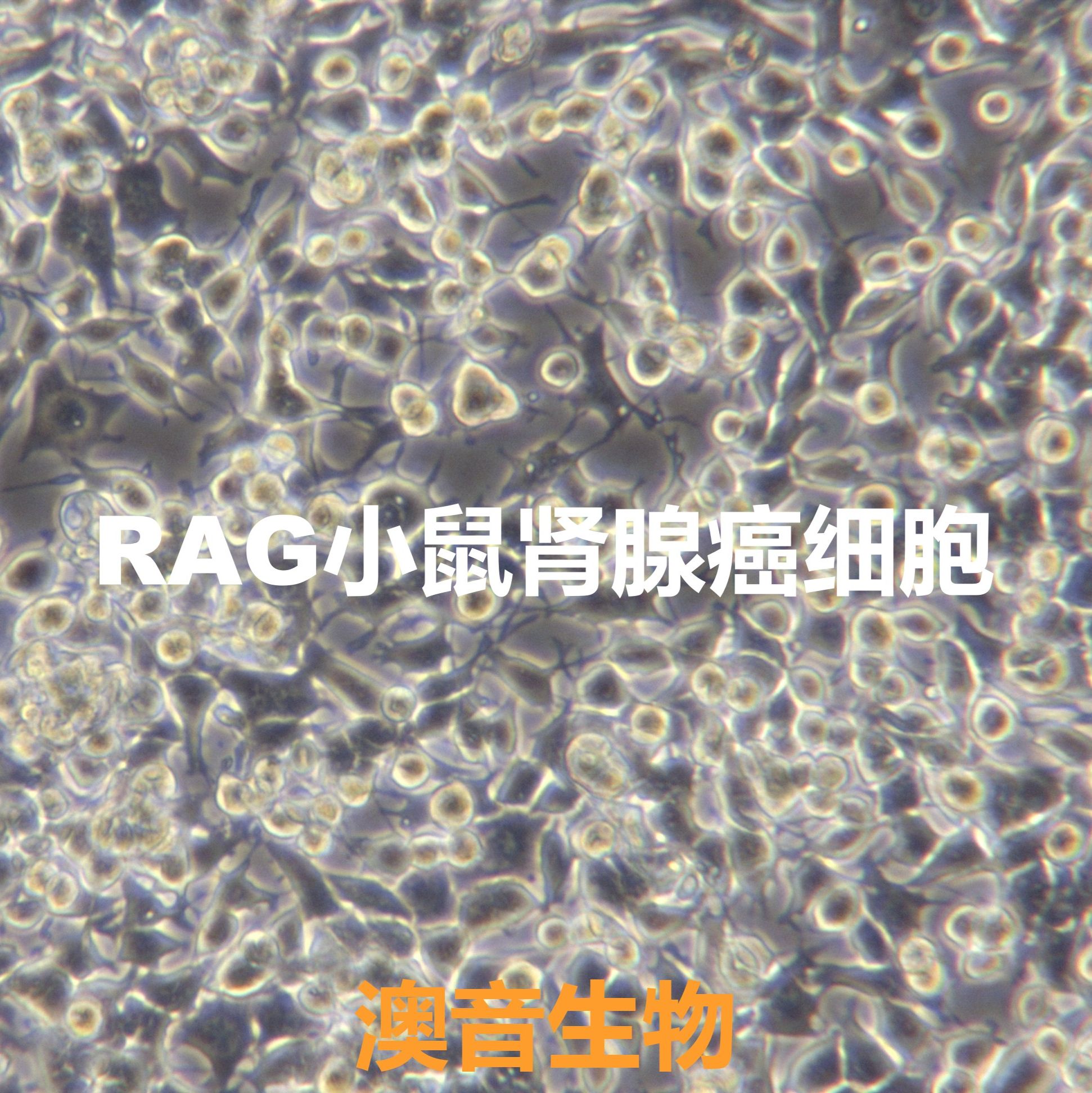 RAG【Rag】小鼠肾腺癌细胞