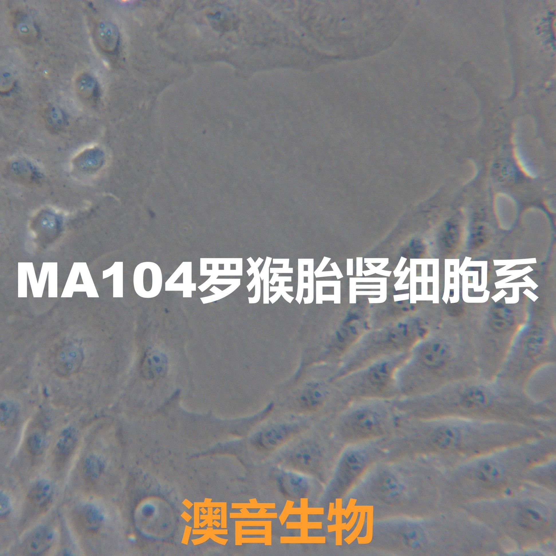 MA104[Ma-104; MA 104; MA104; Microbiological Associates-104]罗猴胎肾细胞系