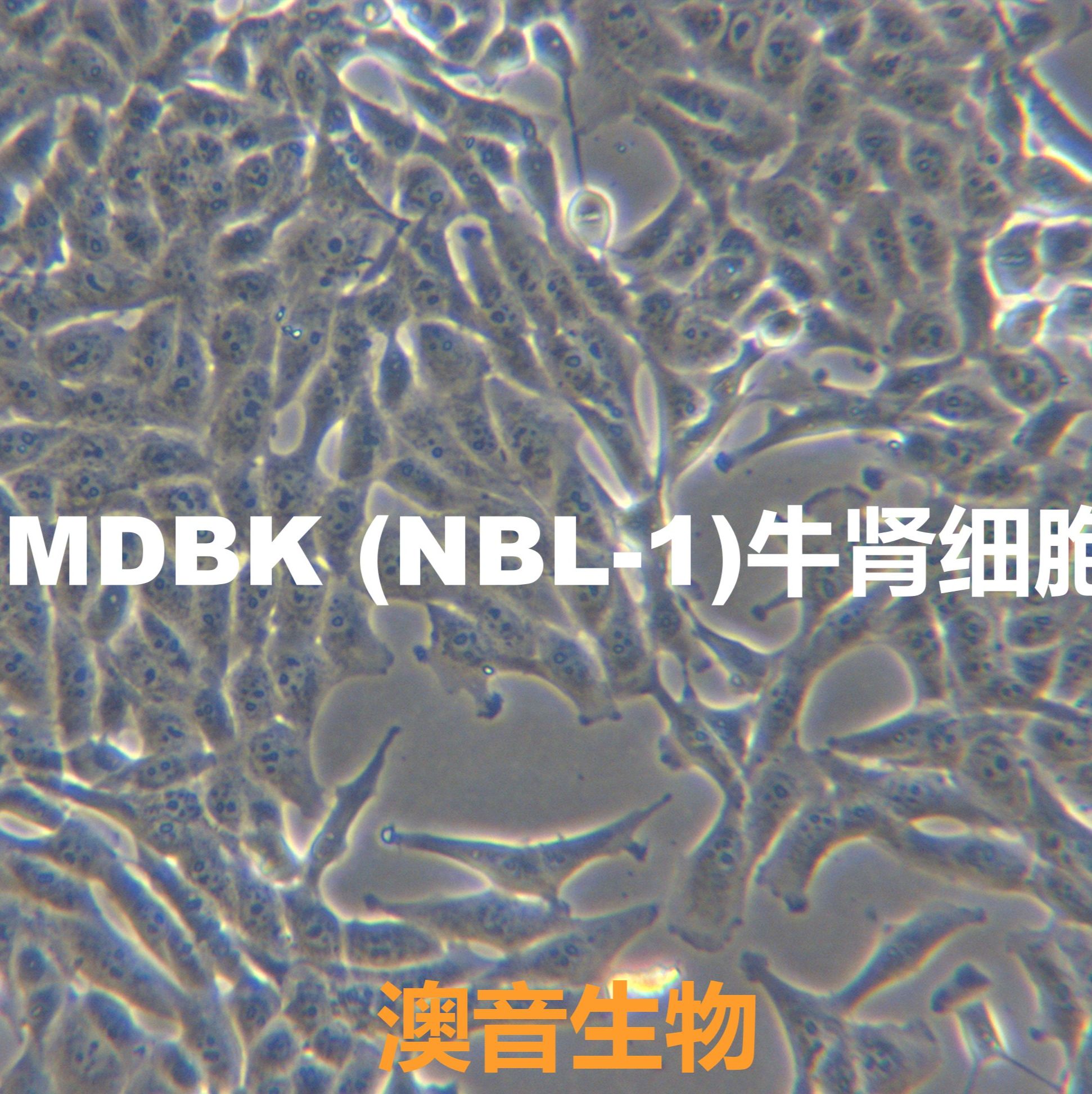 MDBK (NBL-1[	MDBK ;NBL-1; MDBK;mdbk;Madin-Darby Bovine Kidney ]牛肾细胞
