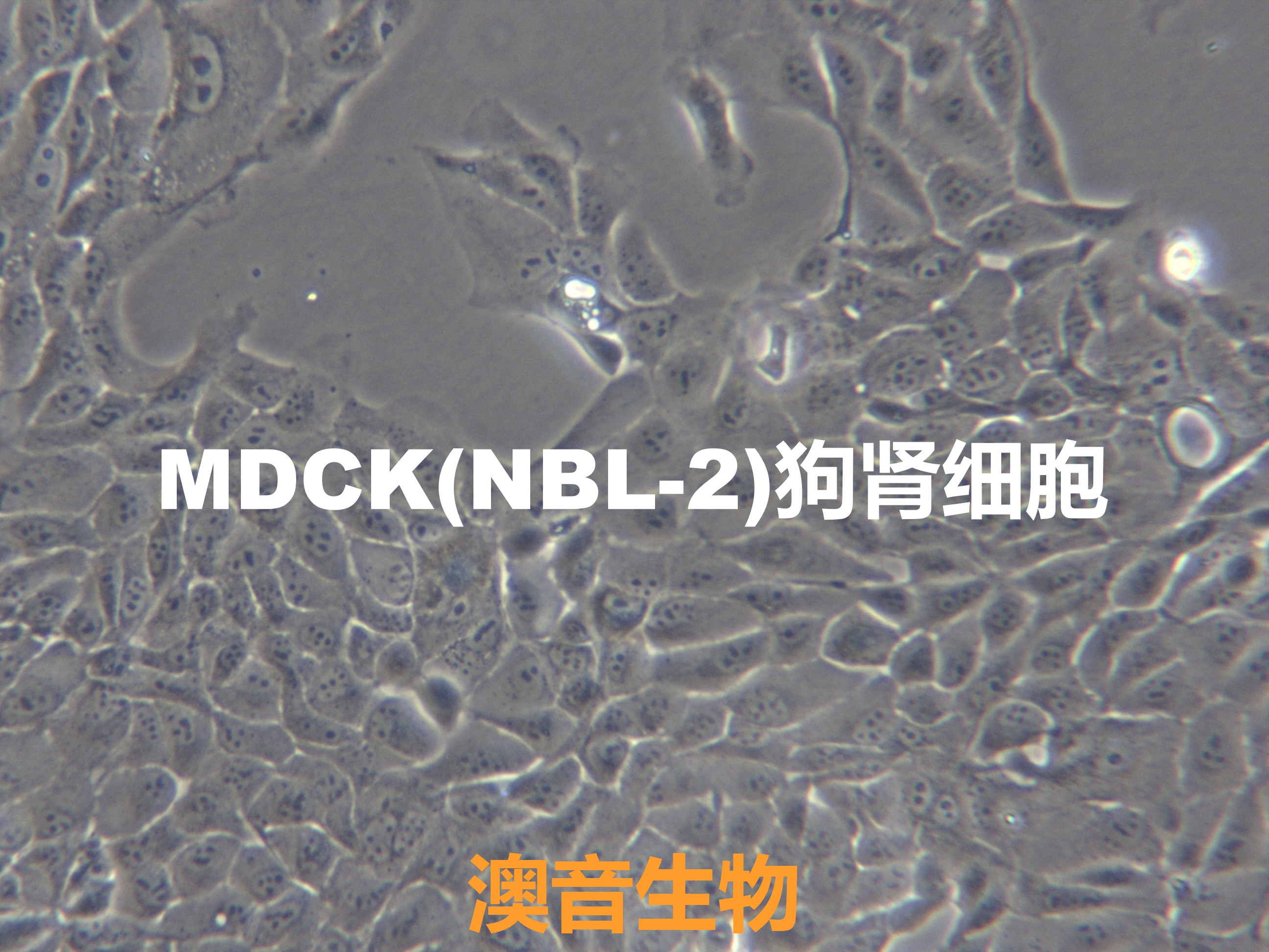 MDCK[MDCK (NBL-2); NBL-2; mdck;MDCK;Madin-Darby Canine Kidney]狗肾细胞价格,详情 ...