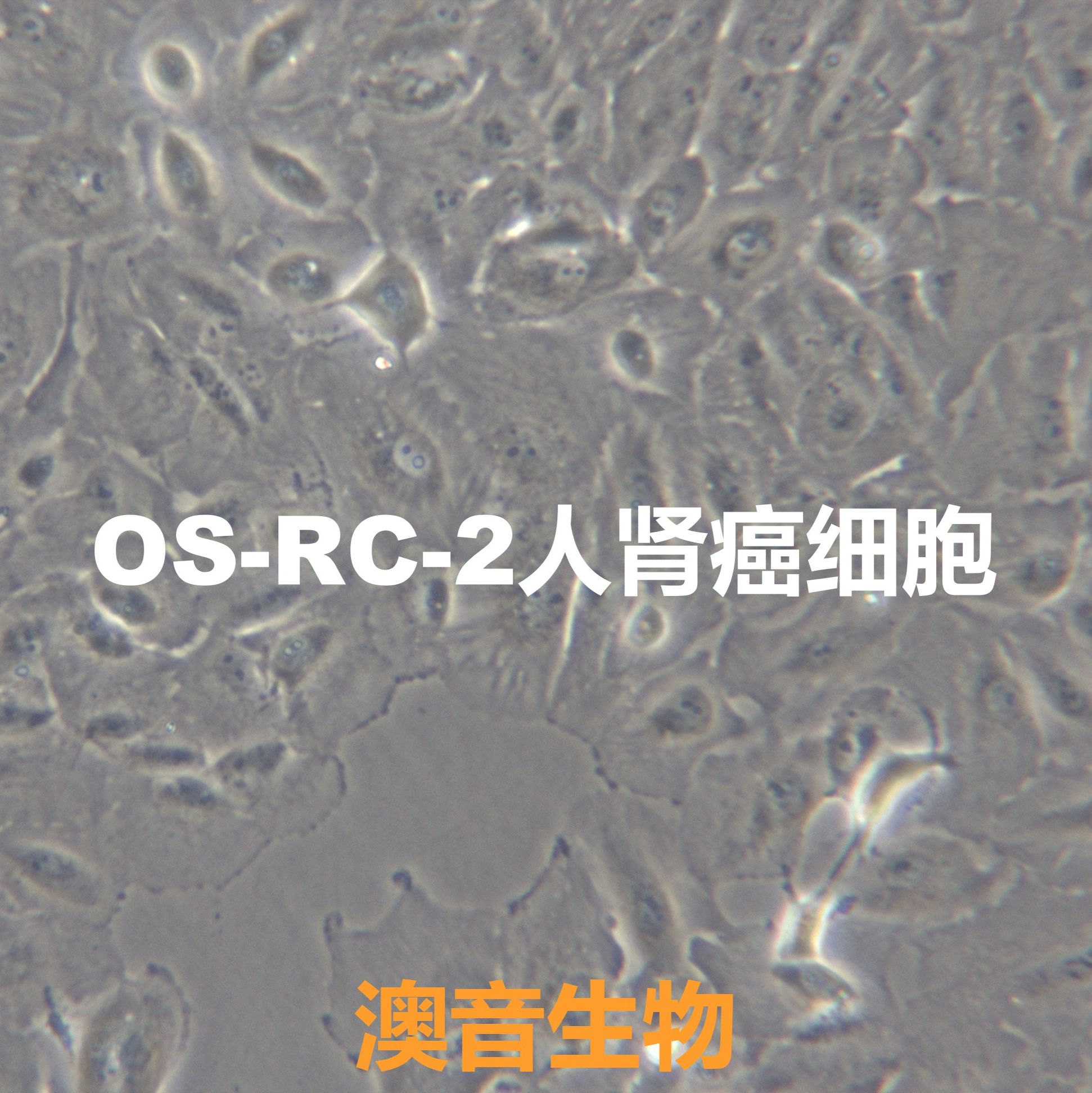 OS-RC-2[OSRC2; RC-2]人肾癌细胞