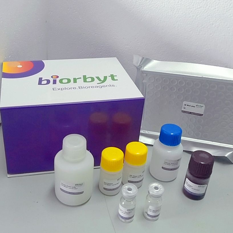 Human CCR7 ELISA Kit,orb550211,Biorbyt
