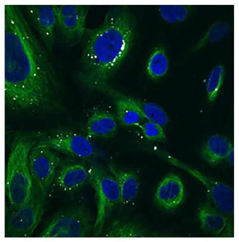 高品质Fluoromount-G荧光封片剂助你顺利get精美免疫荧光图