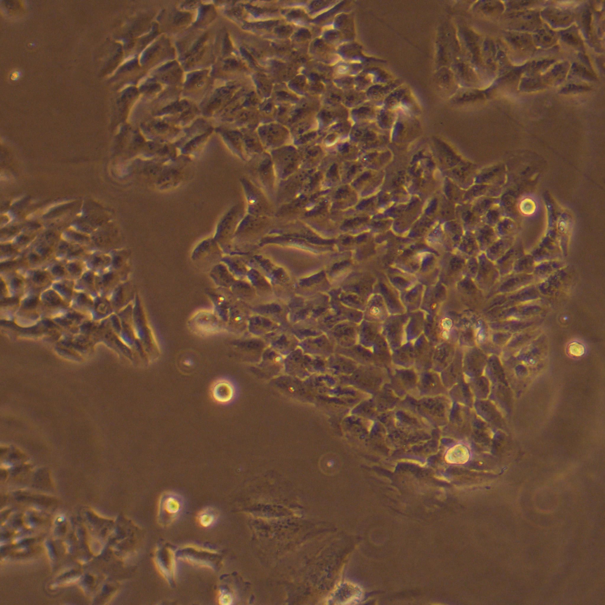 胎盘间充质干细胞