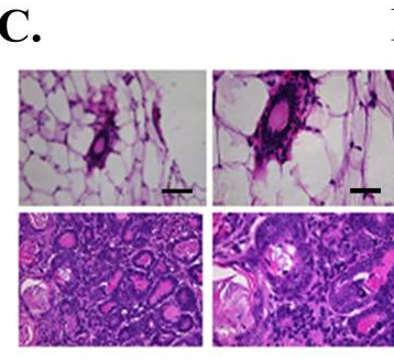 代谢、心血管等疾病相关基因之SIRT3