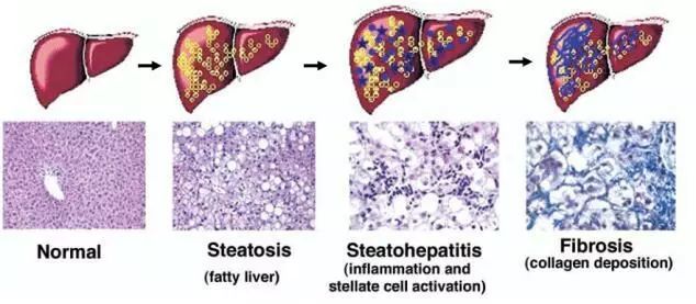 关于脂肪肝模型，你必须要知道的事！