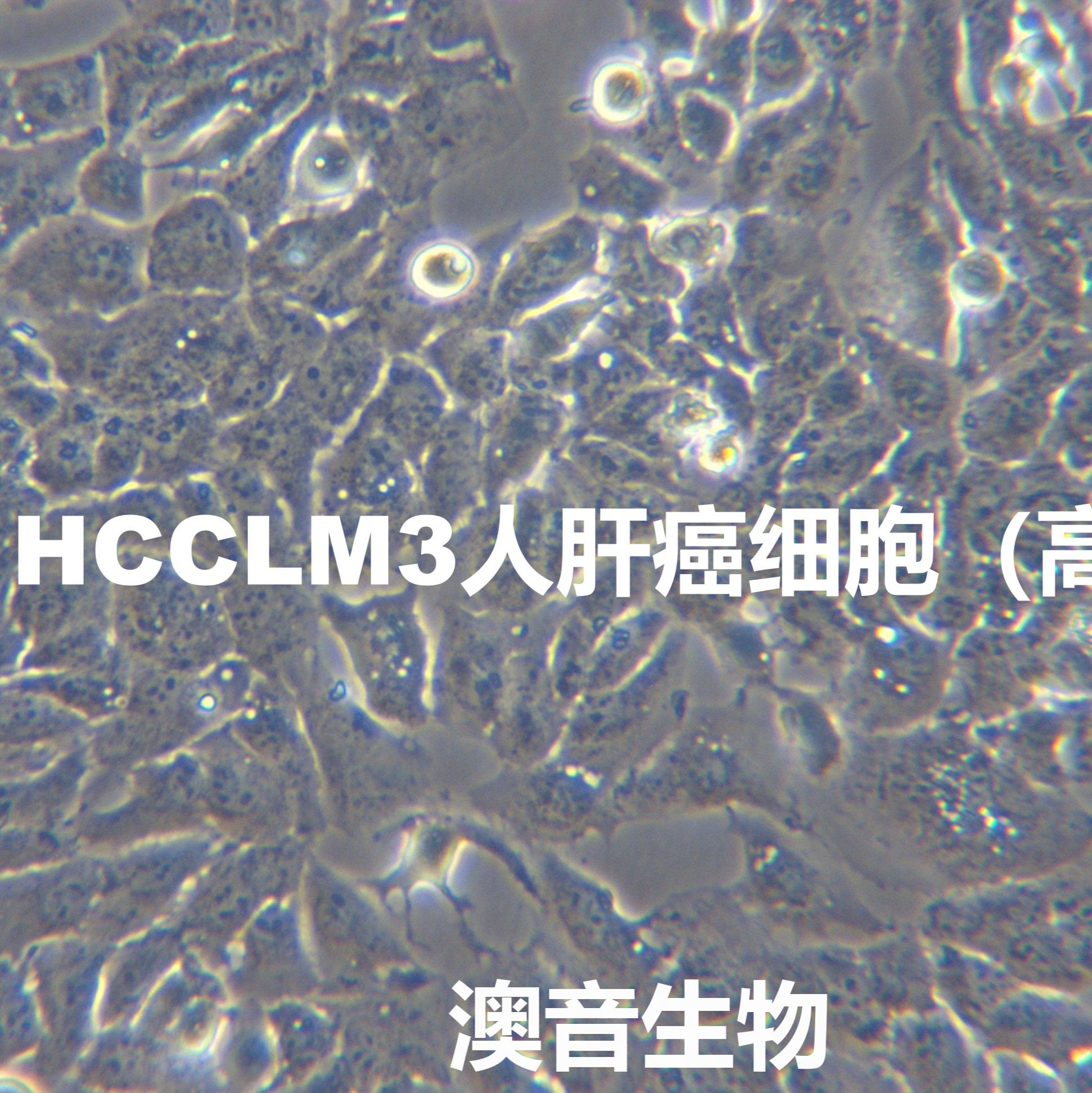 HCCLM3[HCCLM3;LM3; MHCC-LM3; MHCCLM3]肝癌细胞（高转）