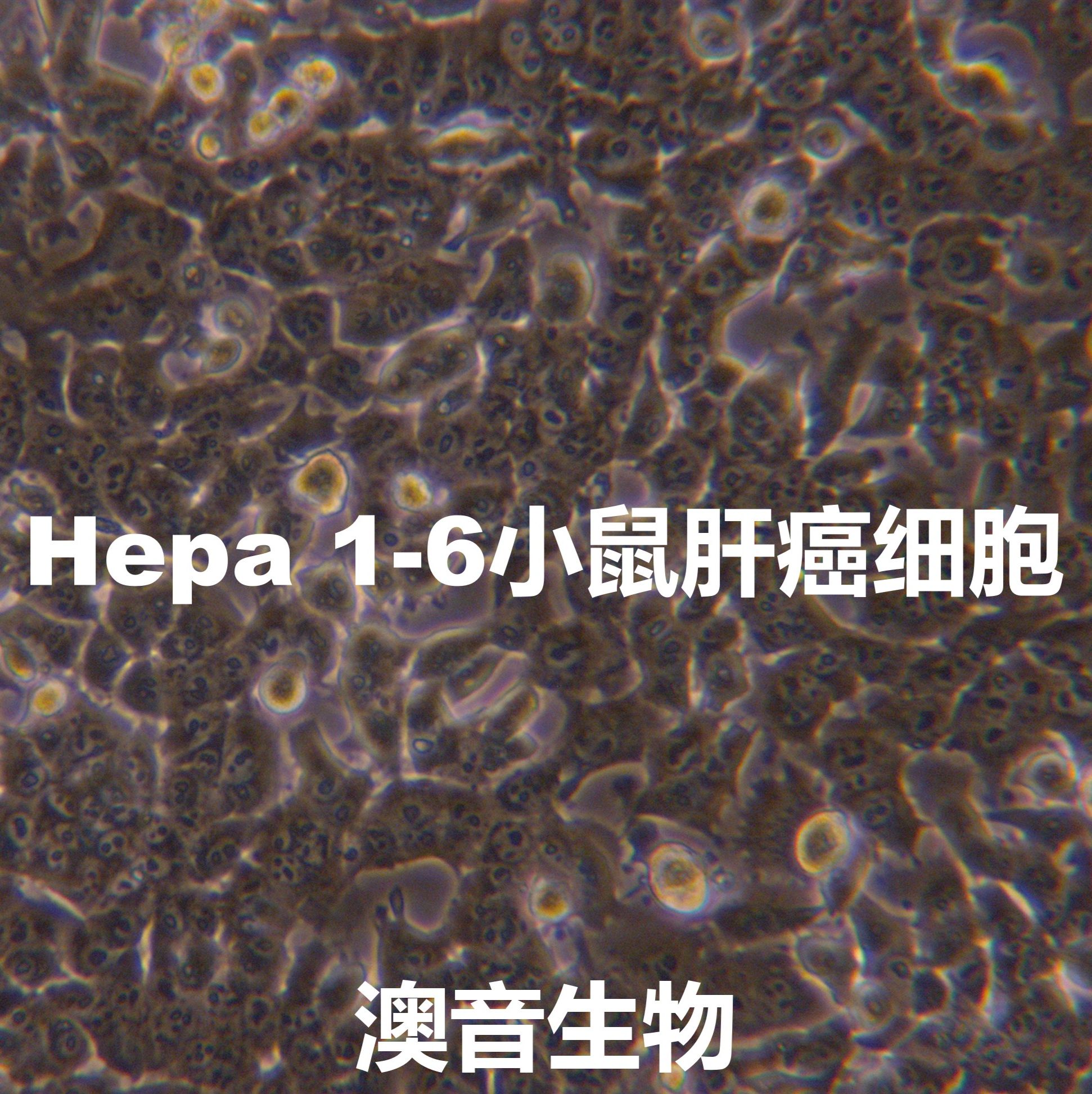 Hepa 1-6【HEPA 1-6; Hepa-1-6; Hepa1-6】小鼠肝癌细胞