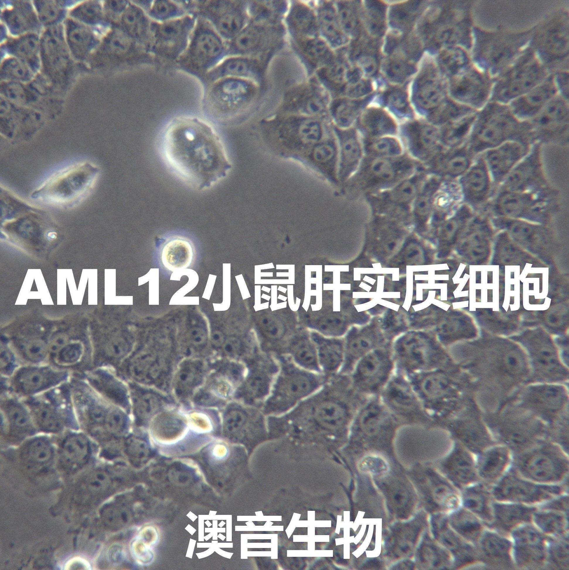 AML12[AML-12; AML 12; Alpha Mouse Liver 12]小鼠肝实质细胞