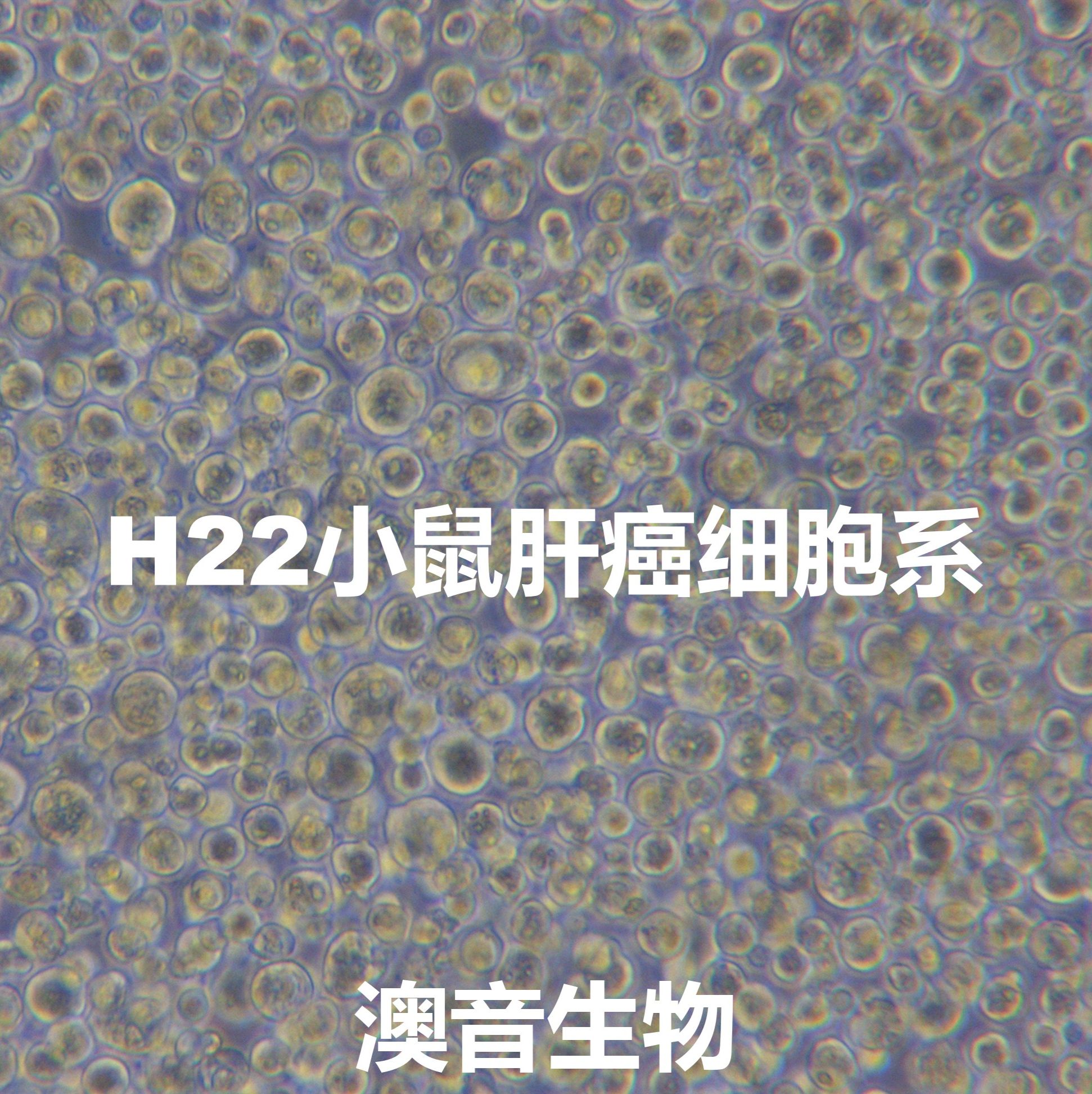 H22【H22;Hepatoma-22; Hepatoma 22】小鼠肝癌细胞系
