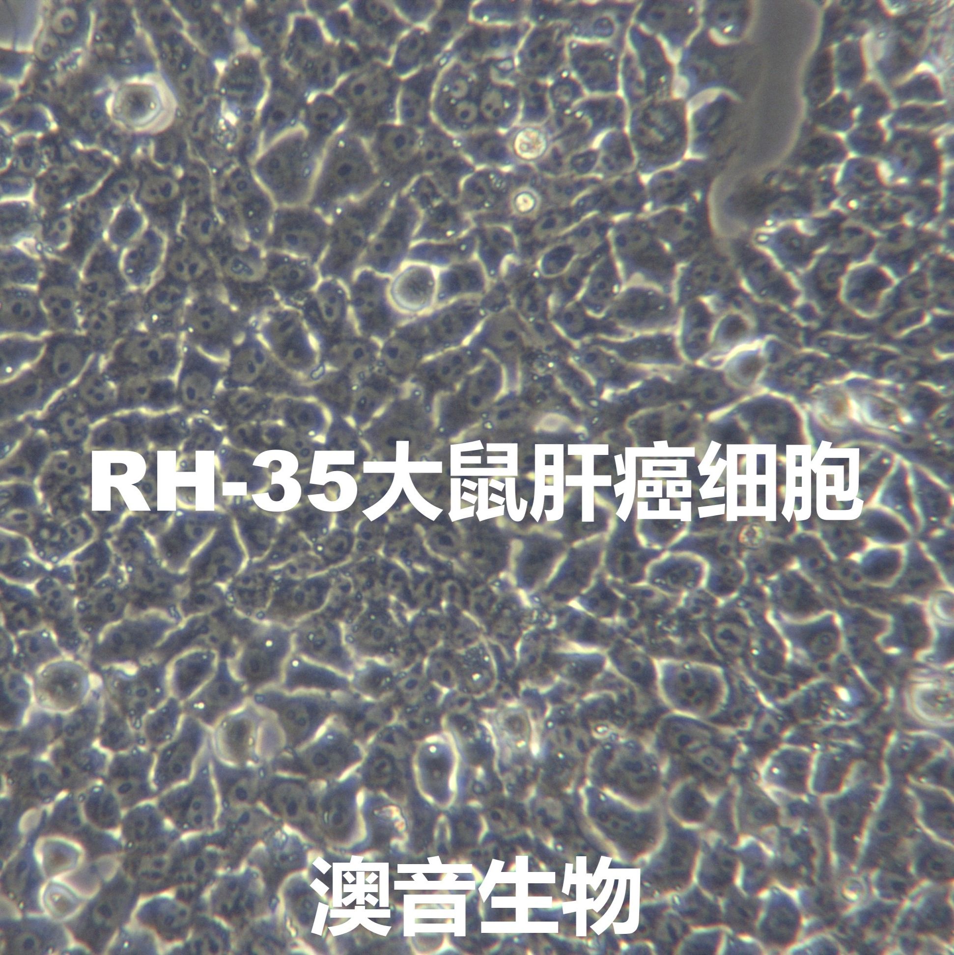 RH-35【RH35; H-35; H35; H-II-E-C3；H4IIEC3; H4-IIE-C3; H4-II-EC3】大鼠肝癌细胞
