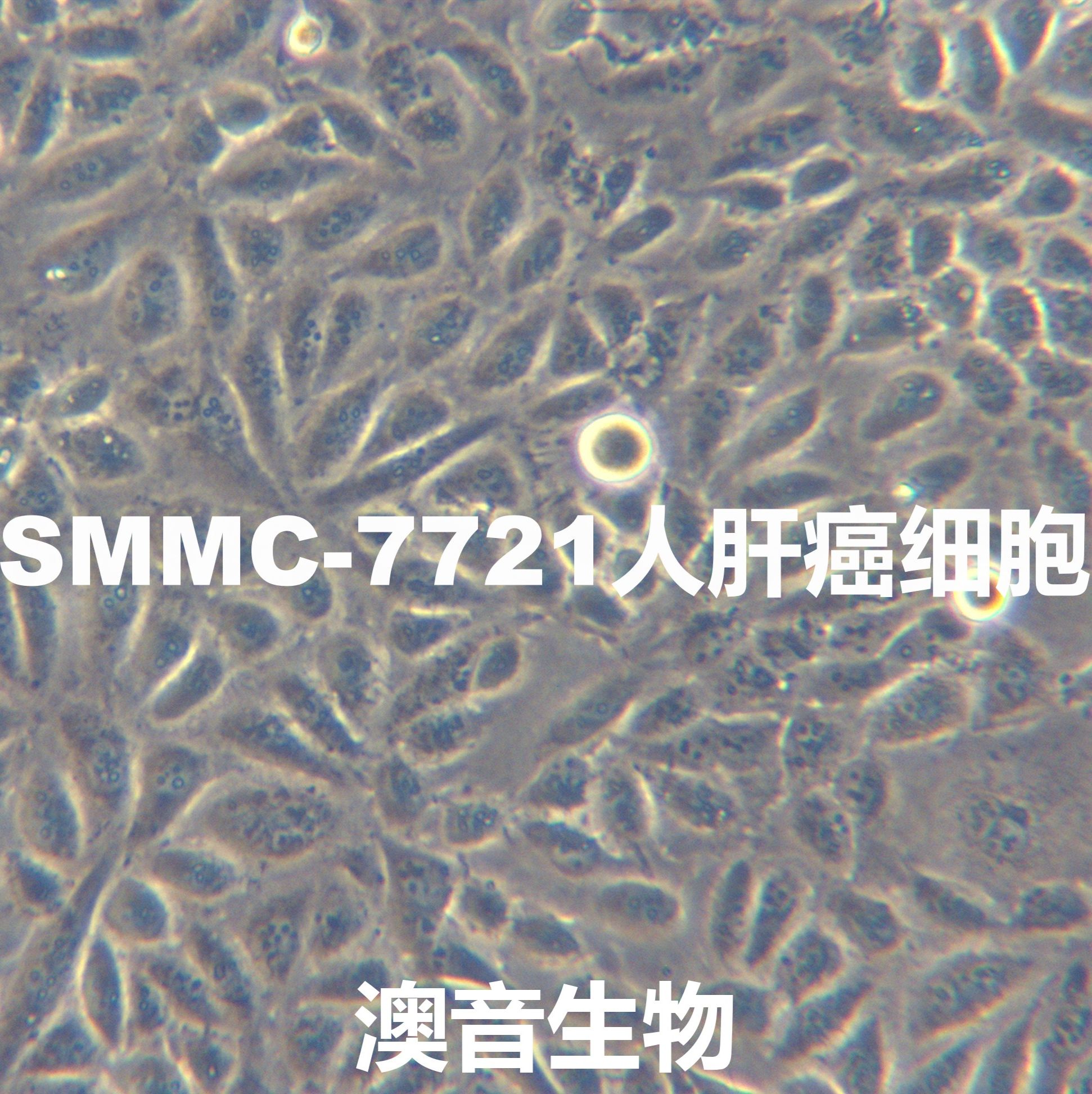 SMMC-7721【	SMMC 7721; SMMC7721; H7721; H-7721】人肝癌细胞