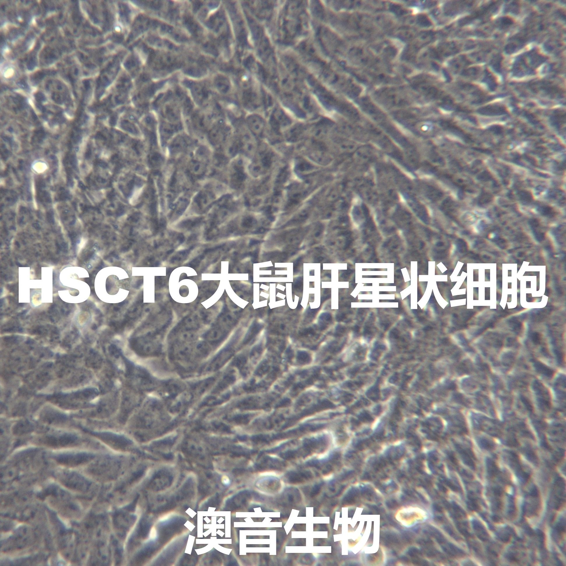 HSCT6【HSC-T6】大鼠肝星状细胞