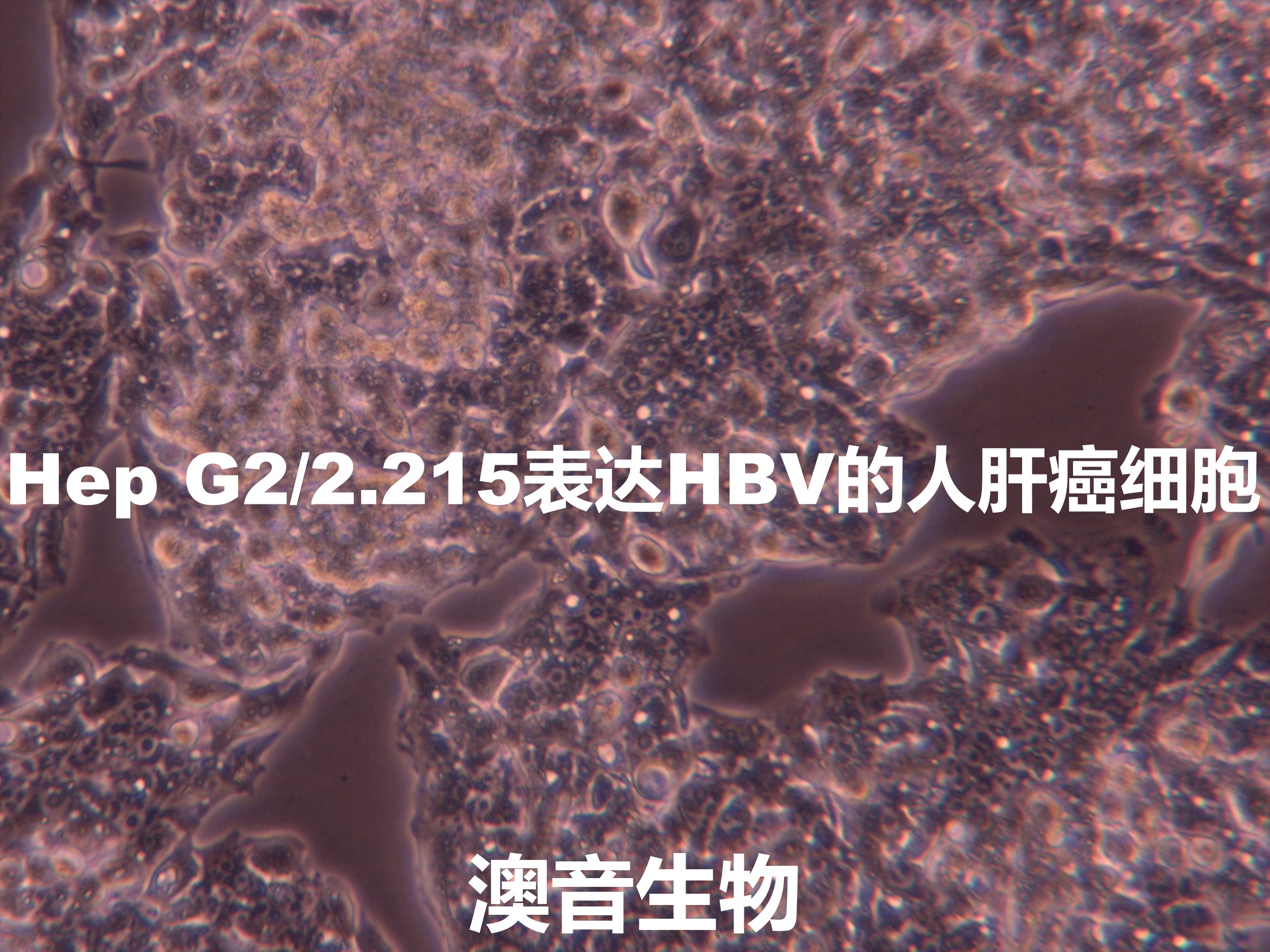 Hep-G2/2.2.15【HEP-G2/2.2.15; H