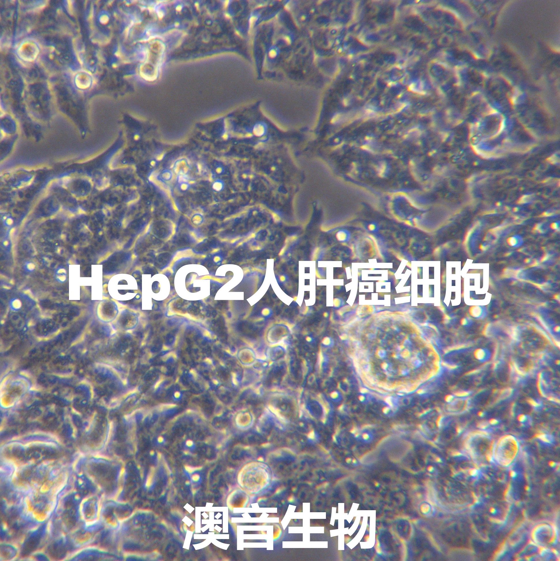 Hep G2[HEPG2;HEP-G2; Hep-G2; HEP G2; HepG2; HEPG2]肝癌细胞