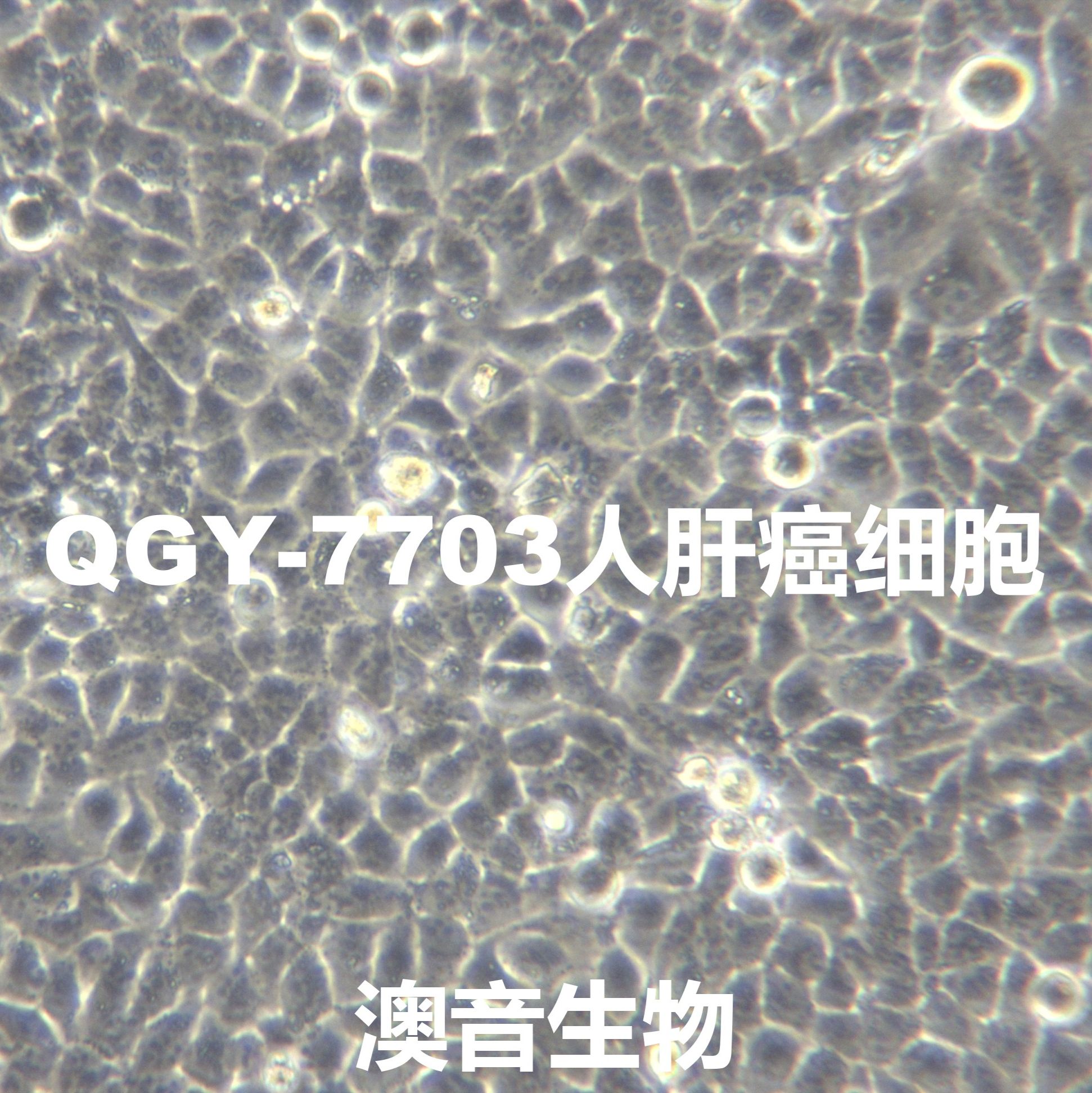 QGY-7703[QGY7703; QGY]人肝癌细胞