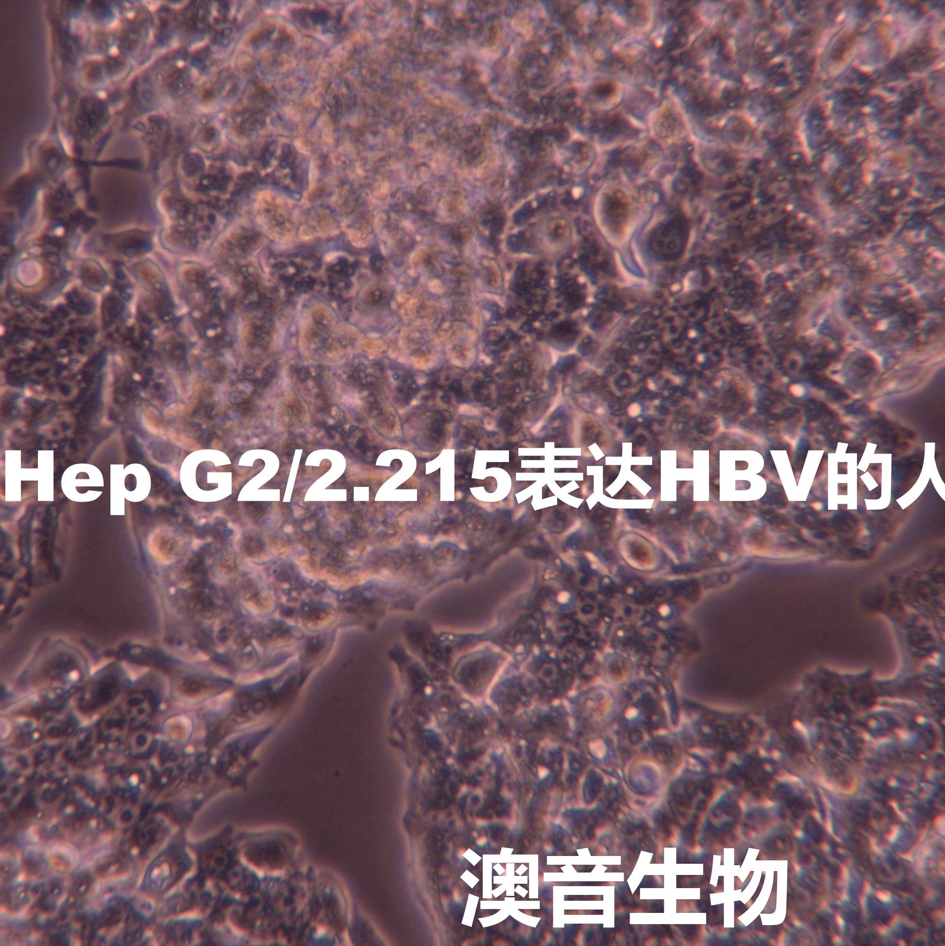 Hep-G2/2.2.15【HEP-G2/2.2.15; Hep-G2/2215; HepG2-2.2.15; HepG2 2.2.15; HepG2.2.15; HepG2(2.2.15); 2.2.15】表达HBV病毒的肝癌细胞