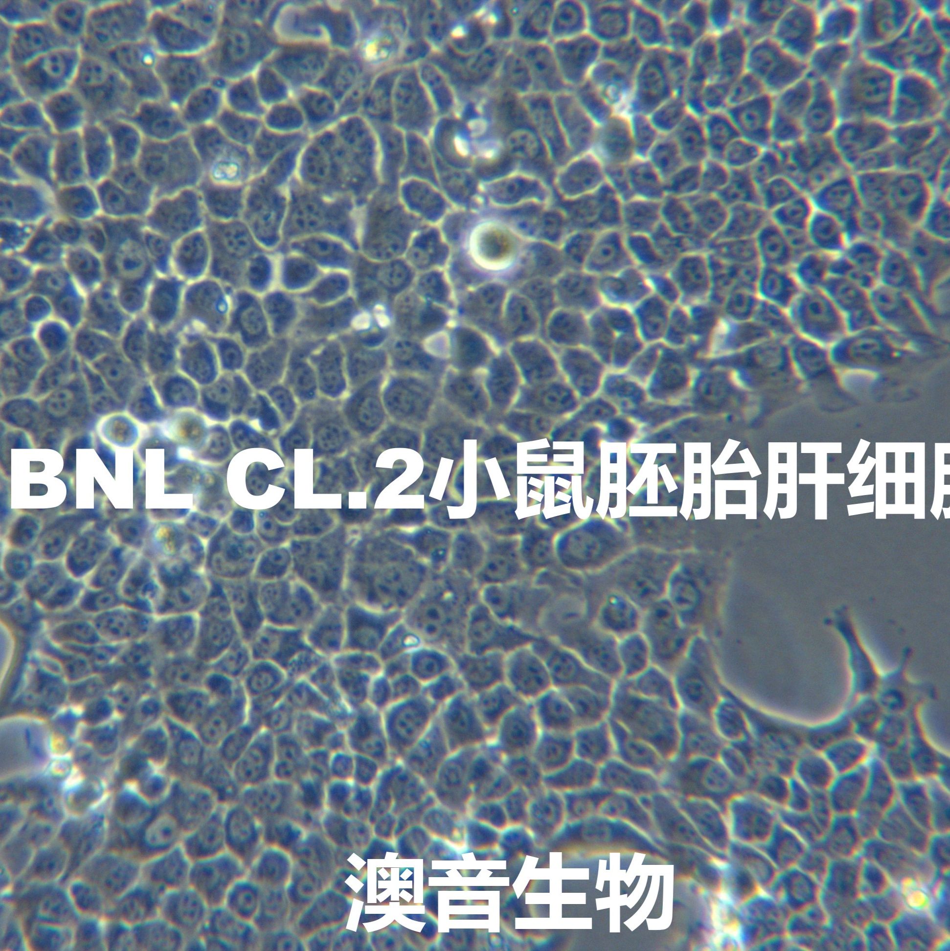 BNL CL.2【BNL-CL.2; BNL CL2; BNL.CL2; BN-CL2; BNCL-2; BNCL2】小鼠胚胎肝细胞
