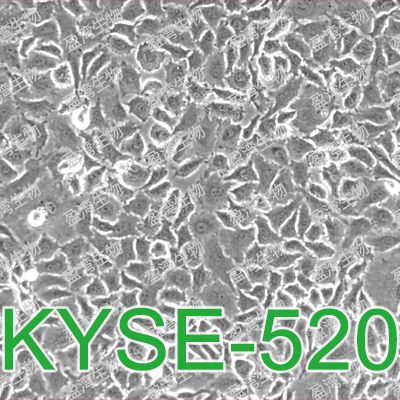 KYSE-520[KYSE 520; KYSE520; Kyse520; KYSE0520]人食管癌細胞