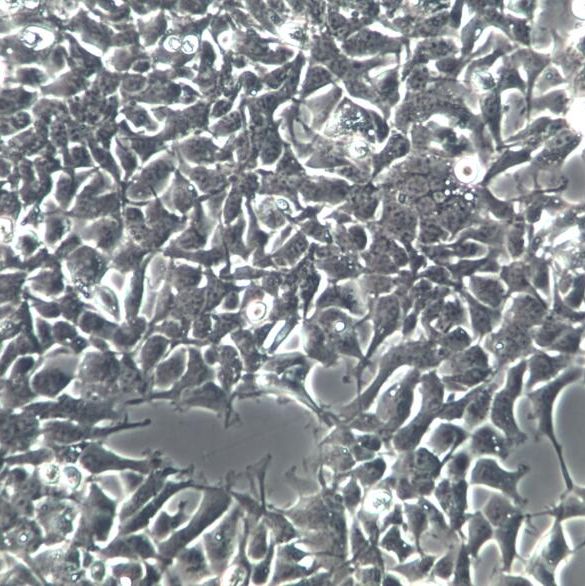 95-D细胞、95D细胞、95-D肺癌细胞