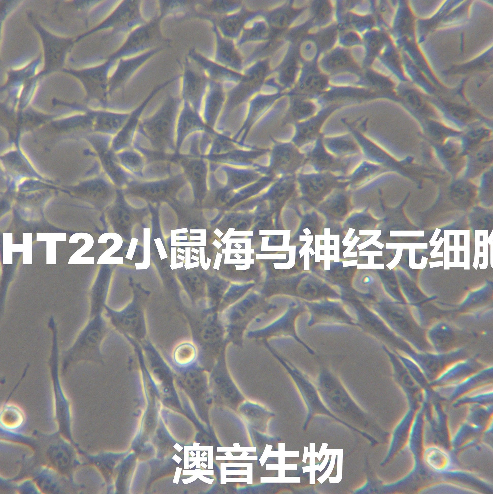 HT22[HT-22]小鼠海马神经元细胞