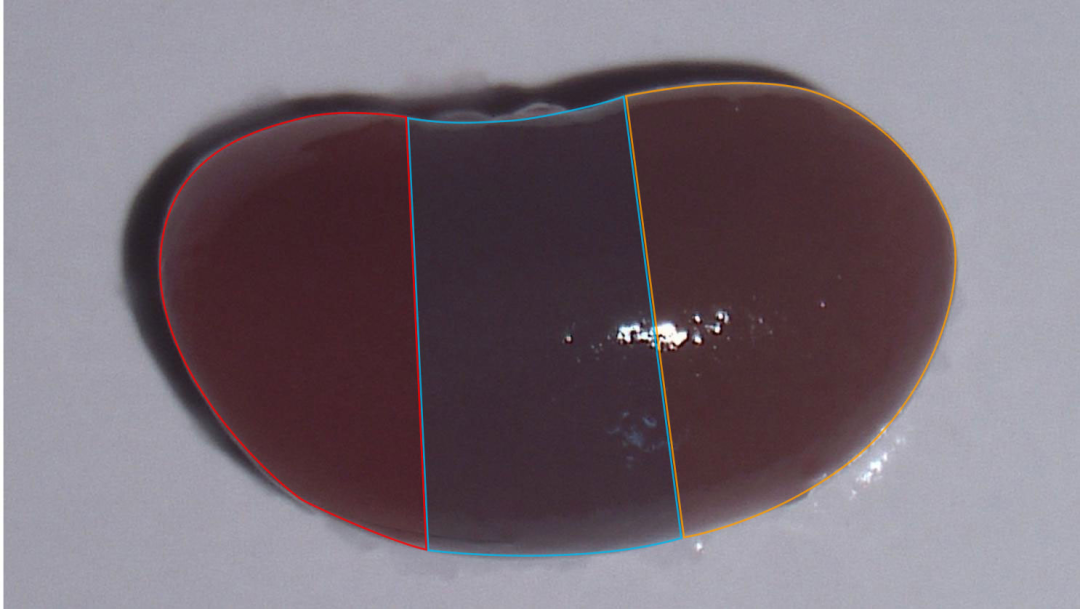 5/6肾切除致慢性肾衰小鼠模型