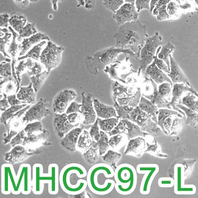 MHCC97-L[MHCC 97-L; MHCC97L]人肝癌细胞（低转）