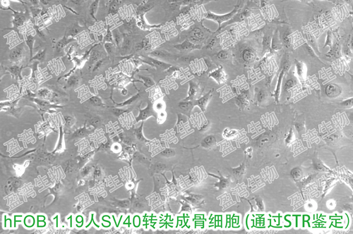 hfob119hfob人sv40转染成骨细胞