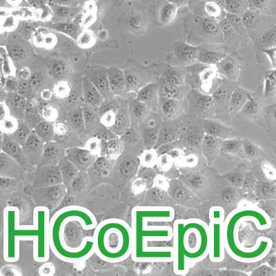 HCoEpiC人正常结肠上皮细胞