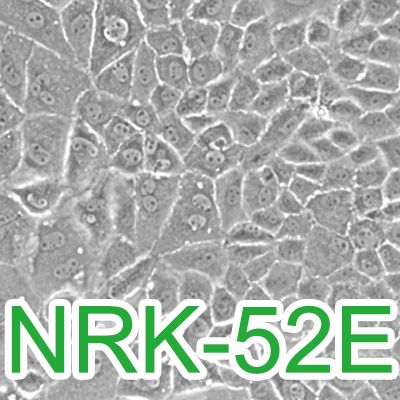 NRK-52E[NRK 52E; NRK52E]大鼠肾小管细胞上皮细胞