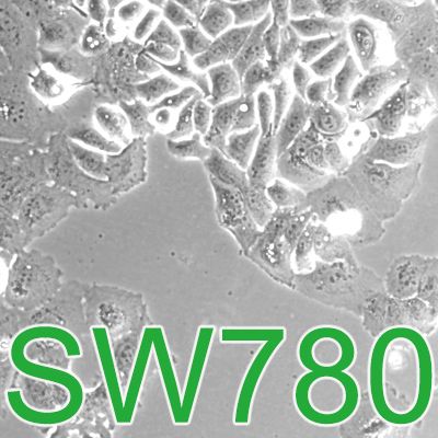 SW780 [SW-780; SW 780]人膀胱移行细胞癌