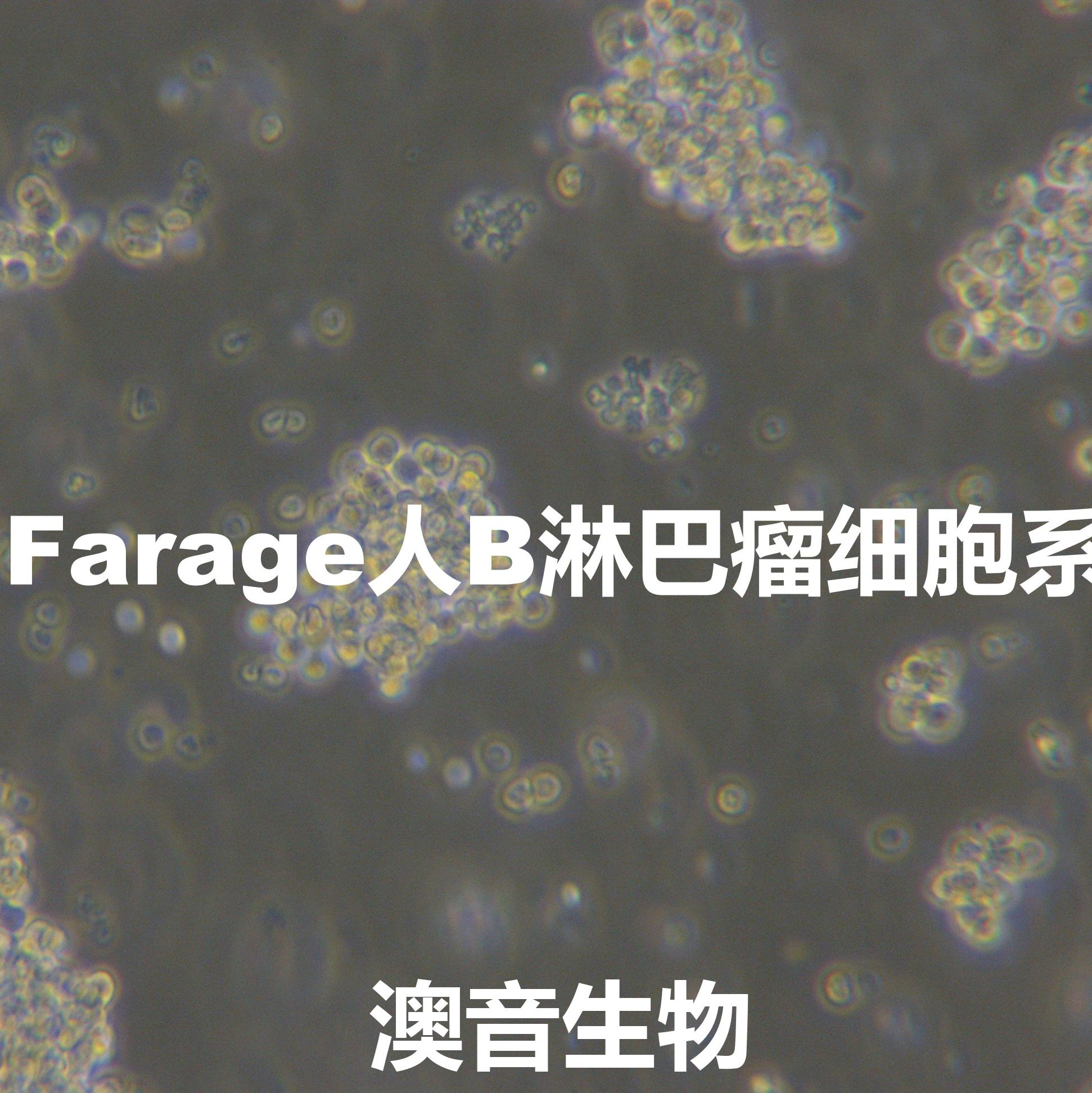 Farage[FARAGE; Farage OL; Farage Original Line]B淋巴瘤细胞
