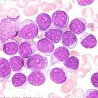 子宫内膜间质细胞