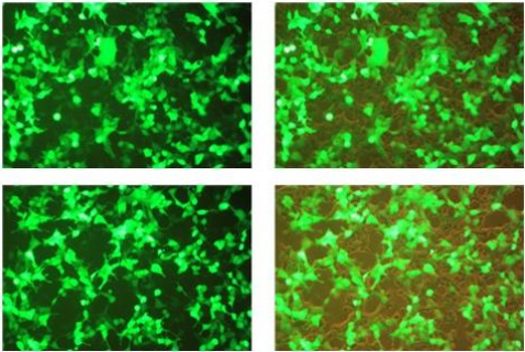 小肠粘膜上皮细胞