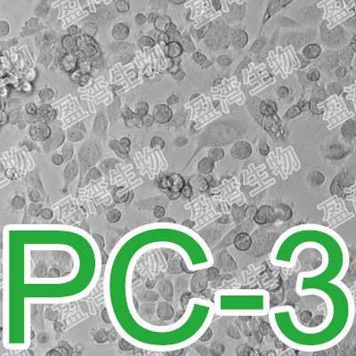 PC-3[PC3; PC.3]人前列腺癌细胞
