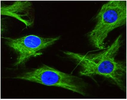 IF/IHC背景太高，来个正常驴血清帮帮忙