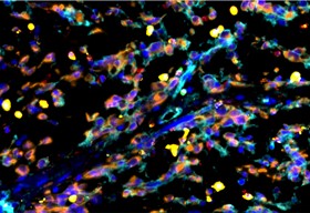 肿瘤微环境如何来解析？