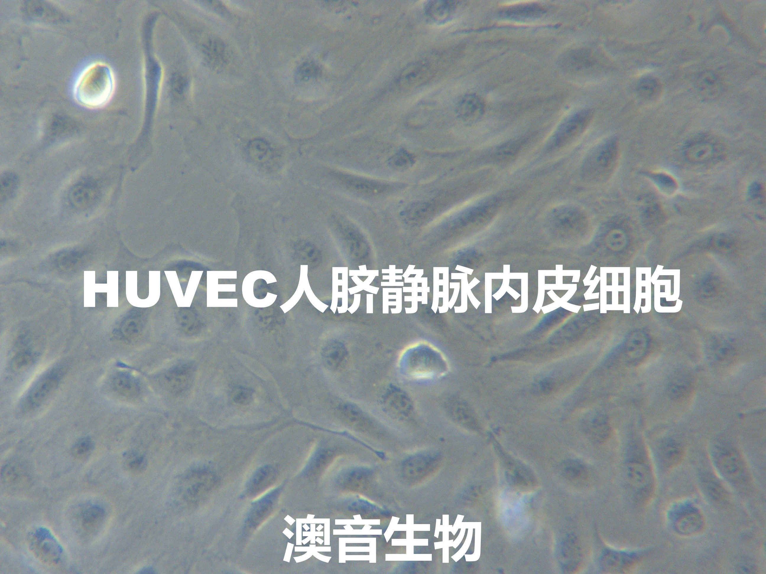 HUVEC【huvec；Huvec】人脐静脉内皮细胞