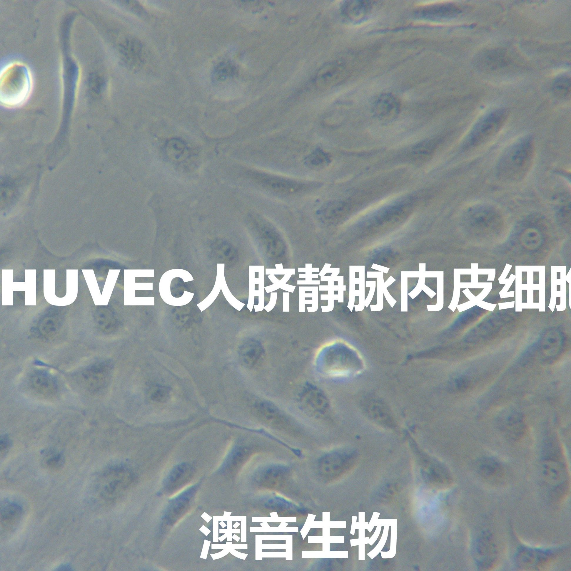 HUVEC【huvec；Huvec】人脐静脉内皮细胞