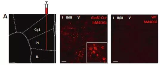  【文献解读】摆脱抑郁！抑制 mPFC 的 GABA 能中间神经元让你和抑郁症说再见