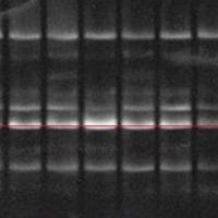 明胶酶谱MMP（2/9）检测实验