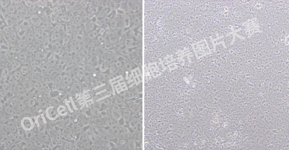 【投票啦】快来投票并学习细胞培养经验吧