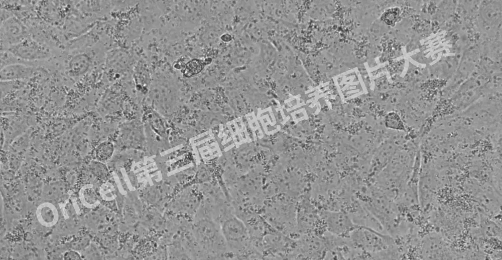 【投票啦】快来投票并学习细胞培养经验吧