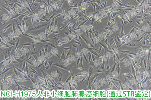 NCI-H1975[H1975; H-1975; NCIH1975]人非小细胞肺腺癌细胞价格,详情介绍-960化工网 – 960化工网