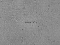 A375 人恶性黑色素瘤细胞