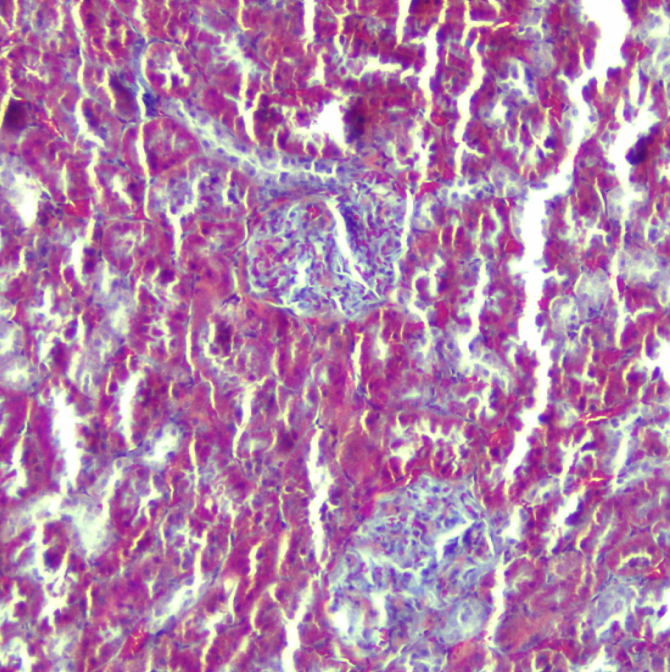 【实用干货】Masson三色染色法