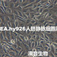 EA.hy926[EAhy926;EA. hy 926; EA hy 926; EAhy 926;EAHY926]人脐静脉细胞融合细胞