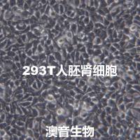 HEK293T【Hek293T; HEK-293T; HEK 293T; HEK-293-T; HEK 293 T; 293-T; 293 T; 293T; Human Embryonic Kidney 293T; 293tsA1609neo】人胚肾细胞